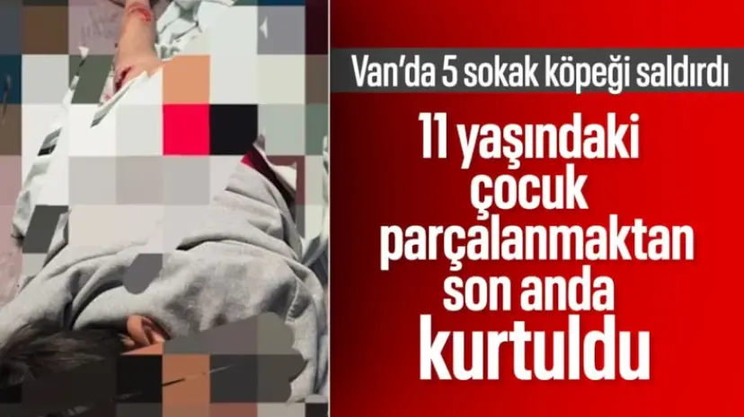 Van’da sokak köpeği dehşeti: 11 yaşındaki çocuk ölümden döndü