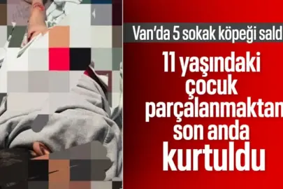 Van’da sokak köpeği dehşeti: 11 yaşındaki çocuk ölümden döndü